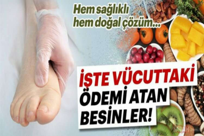 Vücuttan ödem atmaya yardımcı 10 etkili öneri