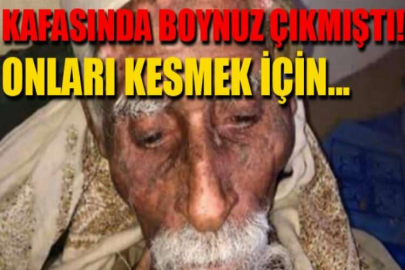 Kafasında boynuz çıkmıştı! Onları kesmek için...
