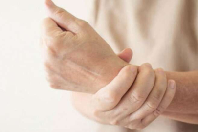 Eldeki renk değişimlerine dikka