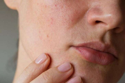 Portakal kabuğunun cilt üzerindeki faydası