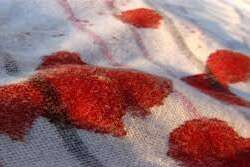 Kurumuş kan lekesi nasıl çıkar?