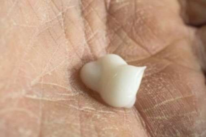 Cilt soyulması için evde çözüm