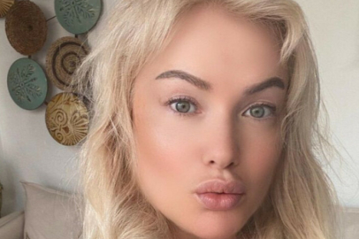 Hilal Cebeci'nin son hali ortaya çıktı! Estetikle bambaşka biri oldu