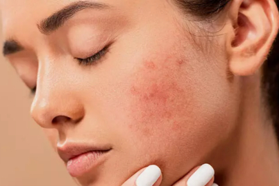 Bir arada kullanmamanız gereken cilt bakım içerikleri