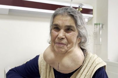 Doktordan korktuğu için yıllarca devasa kitleyle yaşadı