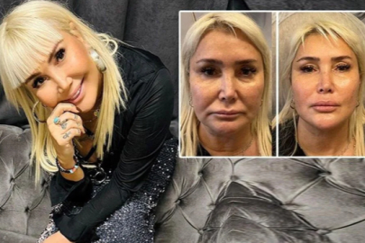 Yonca Evcimik'in Yüzündeki Değişim Sosyal Medyayı Salladı