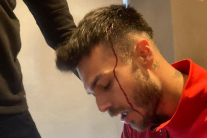 Iğdır'da Olaylı Maç: Kastamonuspor Otobüsü Taşlandı, Oyuncular Yaralandı!