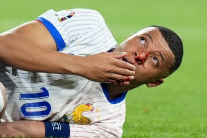 Fransa-Avusturya Maçında Kemik Sesleri! Mbappe'nin Burnu Kırıldı