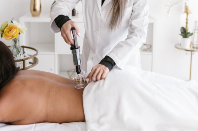 HACAMATIN TARİHİ, FAYDALARI VE YAN ETKİLERİ HAKKINDA KAPSAMLI BİR BAKIŞ!