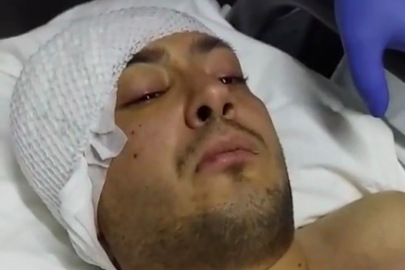 Görevli Uzman Çavuş Başına İsabet Eden Mermi ile Ağır Yaralanmıştı...