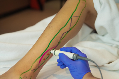 Deri ve Doku Transferlerinin Hayat Kurtaran Rolü