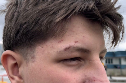 Güvenlik Kamerasına Yansıyan Kazada Yaralanan Gencin Babası: “Çocuklarını kullandırtmasınlar”