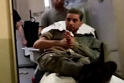 Sunta Keserken Elini Makineye Kaptırdı: Parmağı Koptu