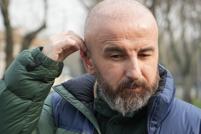 Saç Hayali İçin Gitti, Kulaklarından Oldu