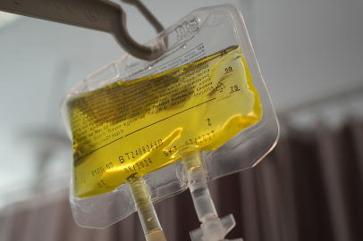 Sarı Seruma Dikkat!