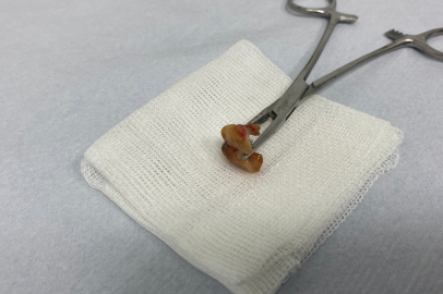 Dayanılmaz öksürükle uyanan adam aynaya bakınca şok oldu