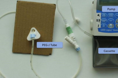 Nöroloji Uzmanı Kumcu:  "Parkinson bir son değil"