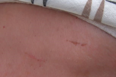 Bayram Günü Darp Edilen Kadın, Komşusunun Çamaşırlarına Kül Attığını İddia Etti