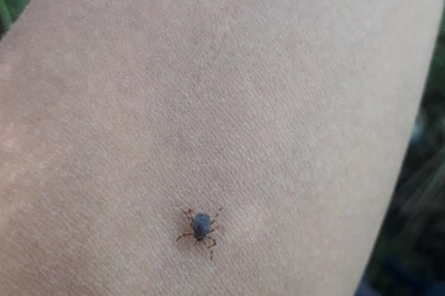 Uzmanla uyardı!  Kene çıkarırken yapılan hatalar...