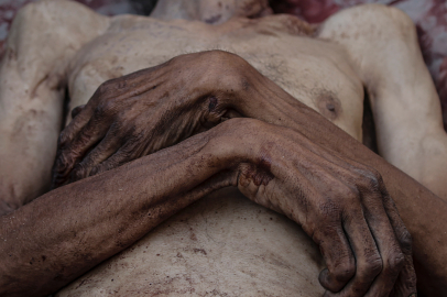 Gazze'de 6 Filistinli Daha Açlıktan Hayatını Kaybetti