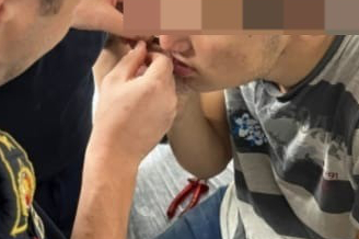 Ağzına balık oltası takılan çocuk, itfaiye ekiplerince kurtarıldı