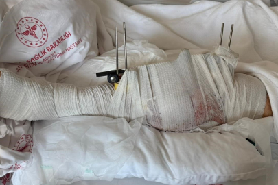 Muhtar dehşet saçtı! Eski damadını vurdu