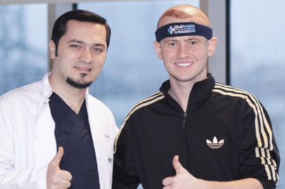 Saç Ekiminden 1 Yıl Sonra Ne Olur? Gerçek Sonuçlar