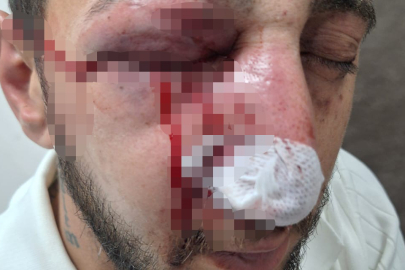 Düğündeki Fedakarlığın Bedeli Ağır Oldu