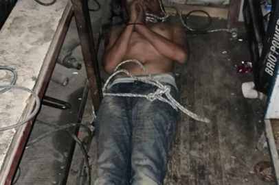 Böcek Yedirip, Dişlerini Kırdılar: İstenilen Ceza Belli Olu