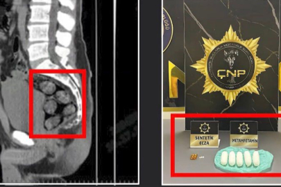 İranlı tacir, yutup midesine sakladığı 173,15 gram uyuşturucuyla yakalandı