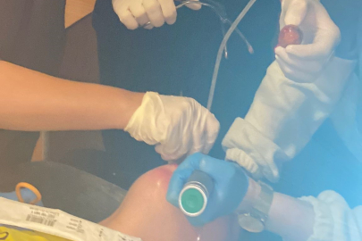 Bütün Olarak Yuttuğu Ceviz Sebebiyle Az Kalsın Canından Oluyordu