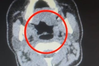 Kayseri'de Uyuşturucu Operasyonu