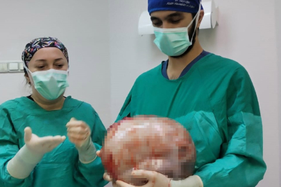 Amasya'da kadının içinden 8,5 kilo ağırlığında kitle çıkarıldı