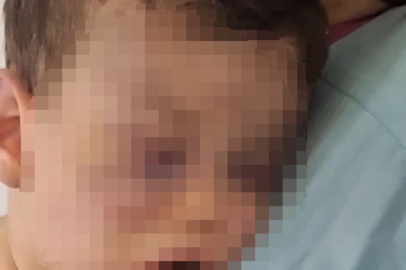 Ölesiye darbedilen Aren bebekte kalıcı hasar olup olmadığı araştırılacak