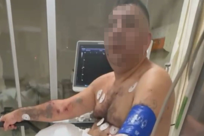 Pompalı tüfekli saldırgan terör estirdi: 1'i polis 4 yaralı