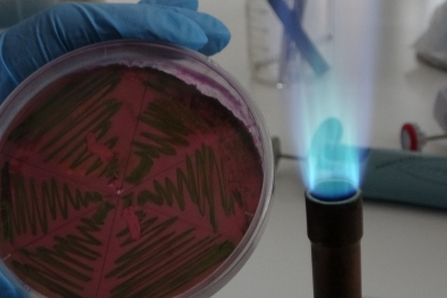 Çiğ Süt İçerken Dikkat!