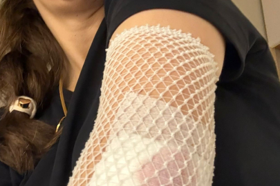 Okul Çıkışında Dehşet: Scooter, Kadına ve Çocuğa Çarptı