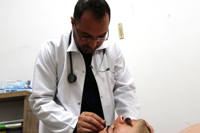 Aile sağlığı merkezlerinde akupunktur ile tedaviye vatandaşlardan ilgi