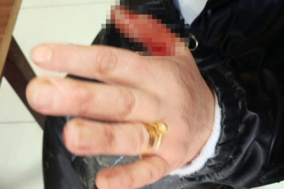 Başıboş Sokak Köpeği 2 Kişiye Saldırdı