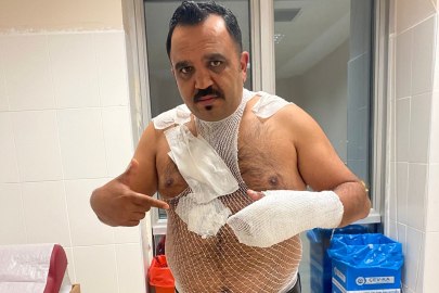 Şov Yapmak İsterken Canından Oluyordu