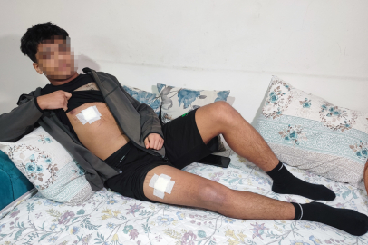 Önce dövüldü sonra bıçaklandı