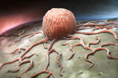 Almanya’da her iki Almandan birinin kansere yakalanması bekleniyor