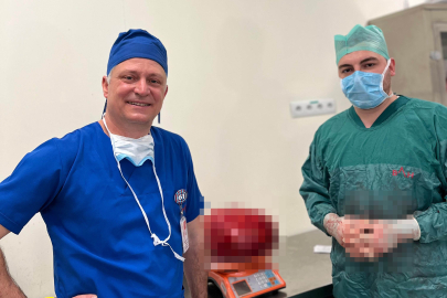 Yaşlı Kadının Karnından Çıkan Görenleri Hayrete Düşürüyor!