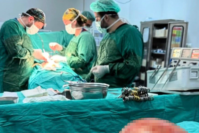 Karın ağrısı şikayetiyle gitti! Doktorlar gözlerine inanamadı