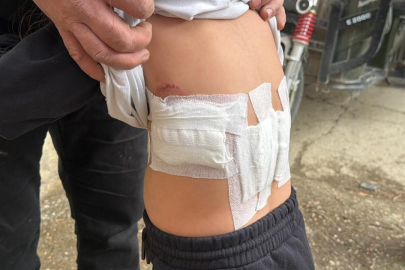 Eşeğin ısırması ve tekmelemesi sonrası ağır yaralanan çocuk hastaneye kaldırıldı