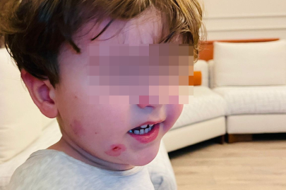 2 yaşındaki çocuk kreşte darp edildi