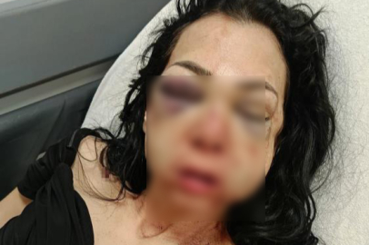 Anne ve oğlunu öldüresiye darp eden şüpheliler: "Merdivenlerden düştü"