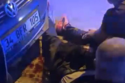 Esenyurt'ta aracına binmek isteyen 22 yaşındaki genç bacağından vuruldu