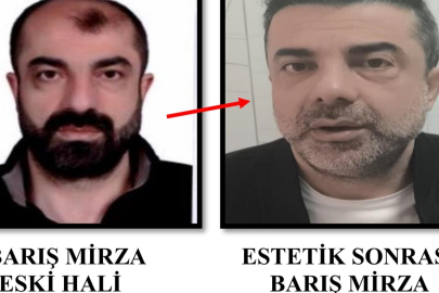 Ankara'da film gibi olay: Ameliyatla yüzünü değiştirdi...