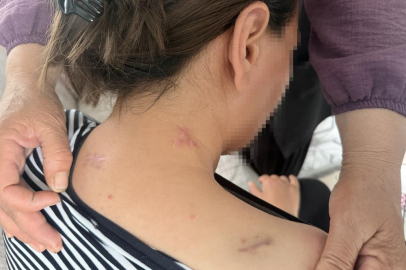 17 bıçak darbesi aldı, ölü numarasıyla kurtuldu